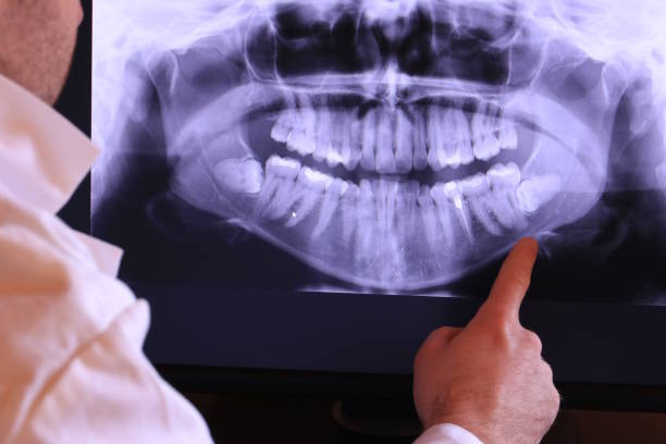 Best Emergency Treatment for Dental Infections or Abscesses in Conway Springs, KS