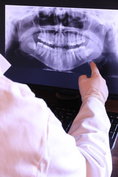 Best Emergency Root Canal Treatment in Conway Springs, KS