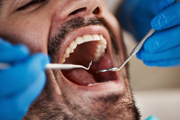 Best Emergency Gum Treatment in Conway Springs, KS